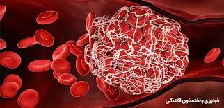 پاورپوینت خونریزی های مامایی